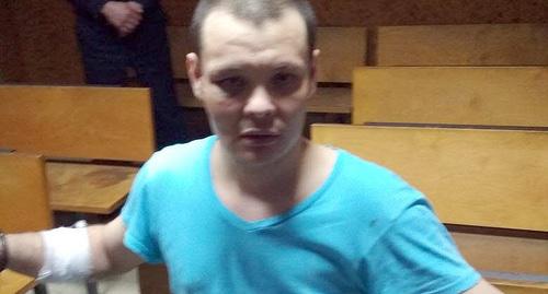 Тимур Муритов со следами побоев и порезов. Фото адвоката Исрафилом Гададовым  для "Кавкуазского узла"