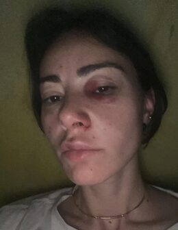 Натиа Бунтури. Скриншот JAMnews.