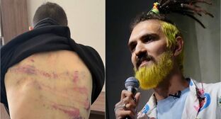 Артемий Останин со следами побоев после задержания и ранее на сцене. Фото: https://t.me/Merkacheva/3467, Telegram-канал "Москва 24" 