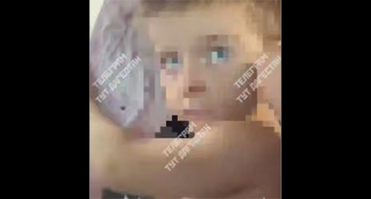 Ребенок пострадавший от мачехи. Скриншот видео https://t.me/tutdagestan_05/16740